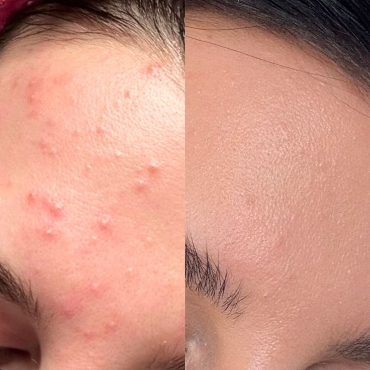RADIANCE RESET DUO
